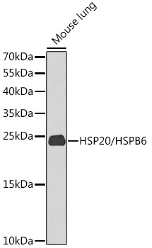 HSP20/HSPB6 Rabbit Polyclonal Antibody