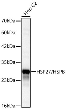 HSP27/HSPB1 Rabbit Polyclonal Antibody