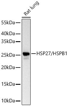 HSP27/HSPB1 Rabbit Polyclonal Antibody - Image 2