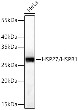 HSP27/HSPB1 Rabbit Polyclonal Antibody - Image 3
