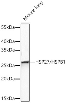 HSP27/HSPB1 Rabbit Polyclonal Antibody - Image 4