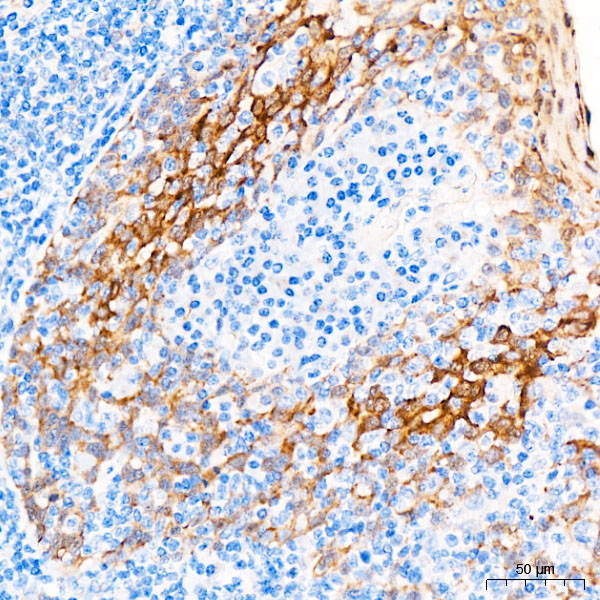 HSP27/HSPB1 Rabbit Polyclonal Antibody - Image 5