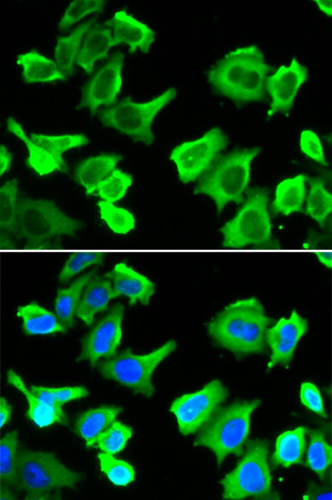 HSP27/HSPB1 Rabbit Polyclonal Antibody