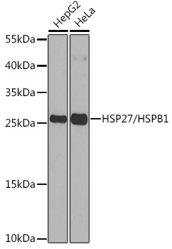 HSP27/HSPB1 Rabbit Polyclonal Antibody