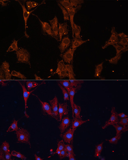 HSP27/HSPB1 Rabbit Polyclonal Antibody - Image 2