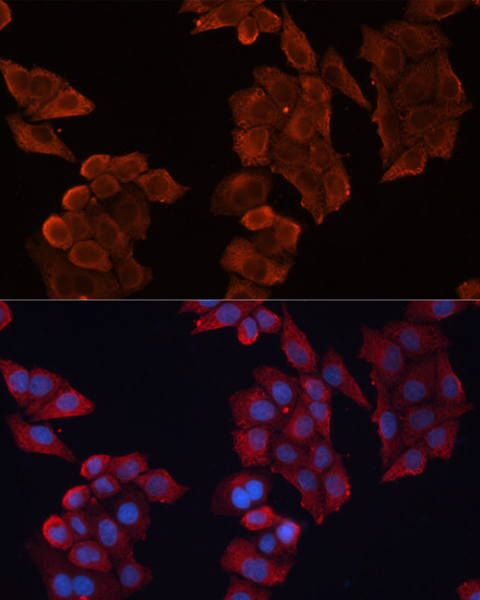 HSP27/HSPB1 Rabbit Polyclonal Antibody - Image 3