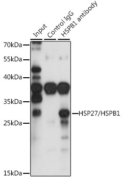 HSP27/HSPB1 Rabbit Polyclonal Antibody - Image 4