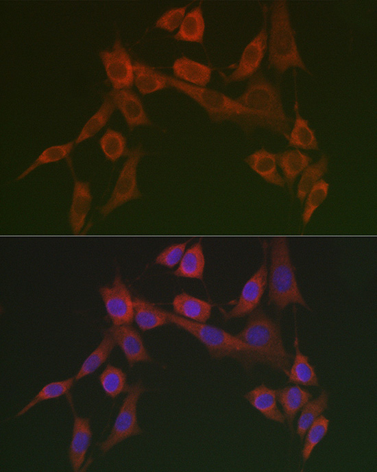 HSP47/SERPINH1 Rabbit Polyclonal Antibody - Image 2
