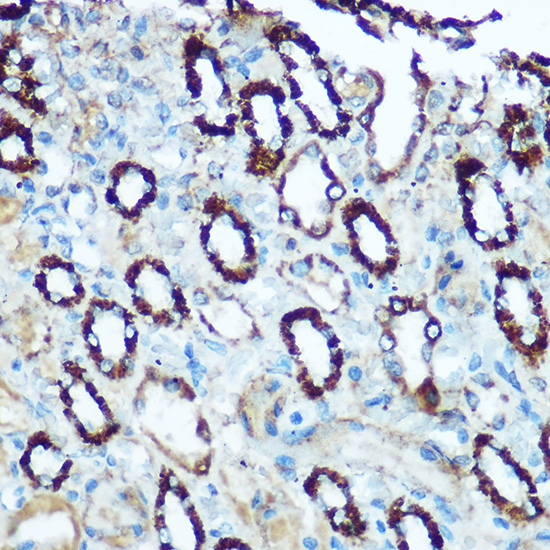 HSP60/HSPD1 Rabbit Polyclonal Antibody - Image 2