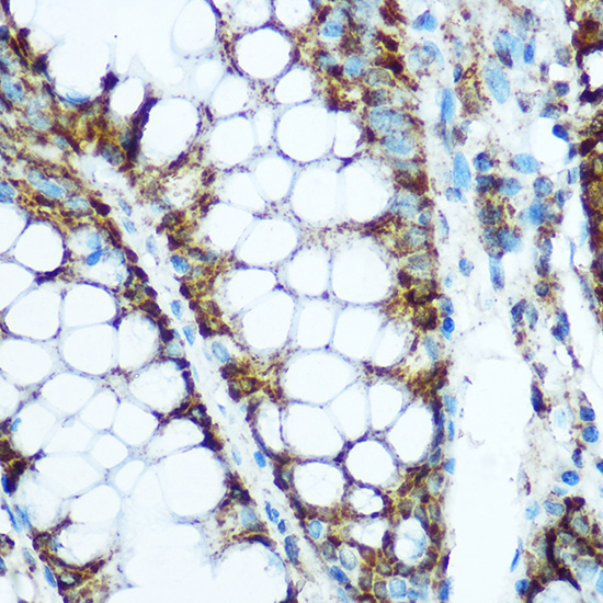 HSP60/HSPD1 Rabbit Polyclonal Antibody - Image 3