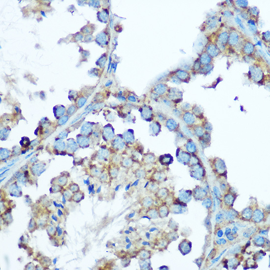 HSP60/HSPD1 Rabbit Polyclonal Antibody - Image 4
