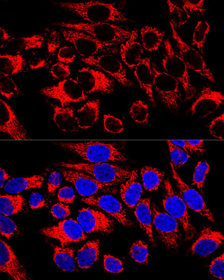 HSP60/HSPD1 Rabbit Polyclonal Antibody - Image 5