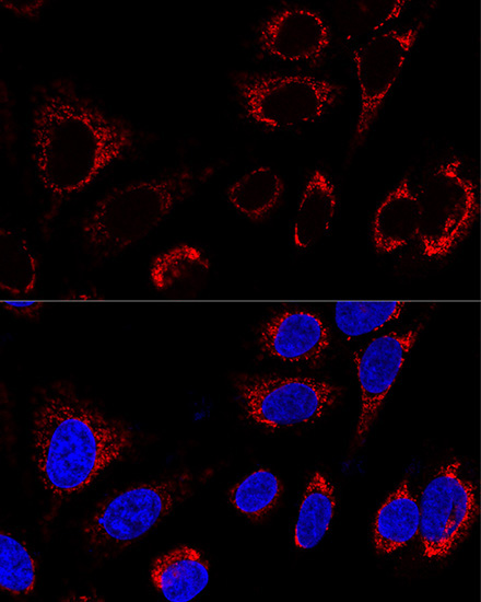 HSP60/HSPD1 Rabbit Polyclonal Antibody - Image 6