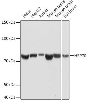 HSP70 Rabbit Monoclonal Antibody