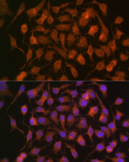 HSP70 Rabbit Monoclonal Antibody - Image 2