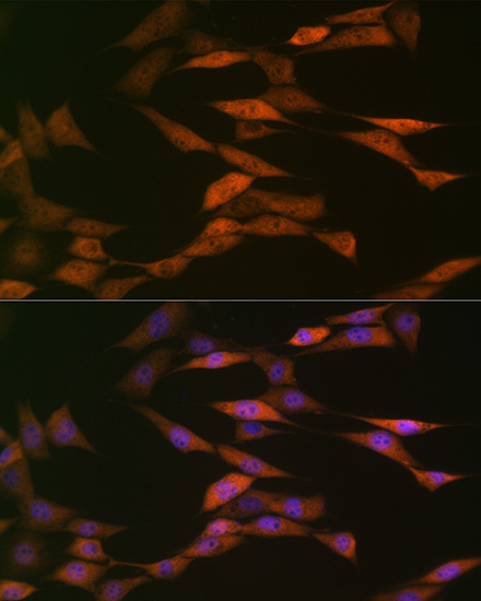 HSP70 Rabbit Monoclonal Antibody - Image 3