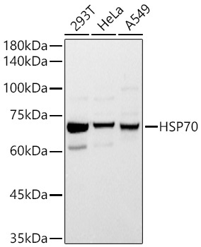 HSP70 Rabbit Polyclonal Antibody