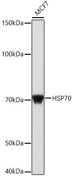 HSP70 Rabbit Polyclonal Antibody