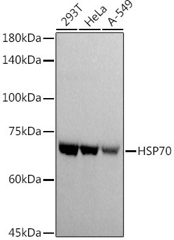 HSP70 Rabbit Polyclonal Antibody