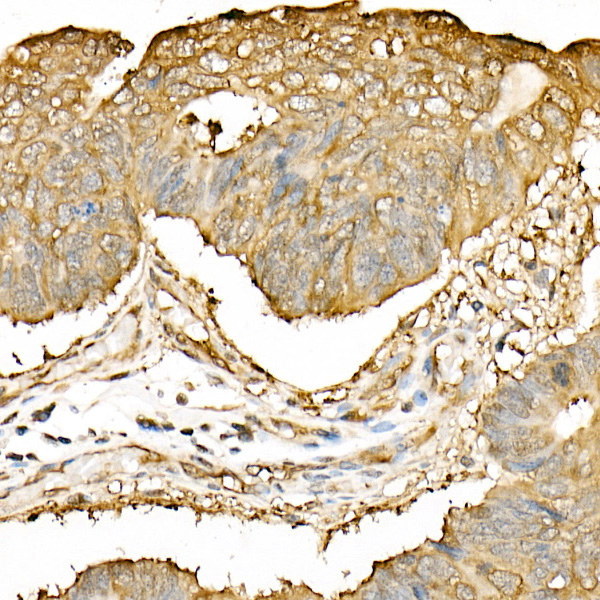 Hsp90Beta Rabbit Polyclonal Antibody - Image 2