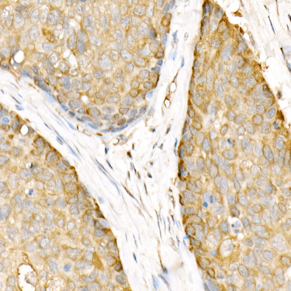 Hsp90Beta Rabbit Polyclonal Antibody - Image 4