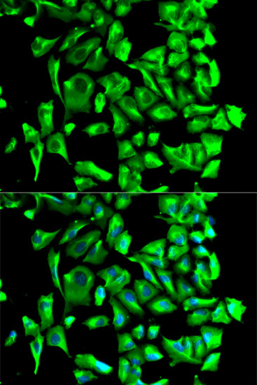 Hsp90Beta Rabbit Polyclonal Antibody - Image 7
