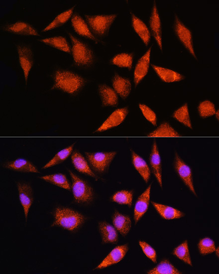 HSPA2 Rabbit Polyclonal Antibody - Image 2