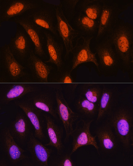 HSPA2 Rabbit Polyclonal Antibody - Image 3