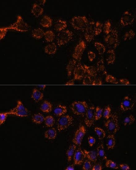 HSPA4L Rabbit Polyclonal Antibody - Image 2