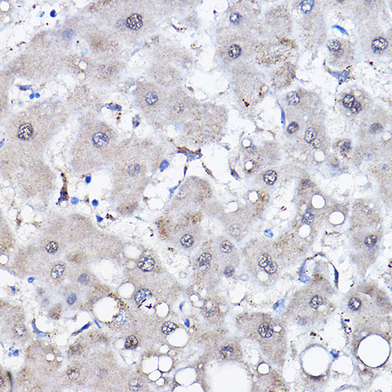 HSPA6 Rabbit Polyclonal Antibody - Image 2