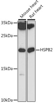 HSPB2 Rabbit Polyclonal Antibody