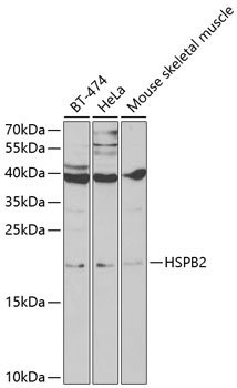 HSPB2 Rabbit Polyclonal Antibody