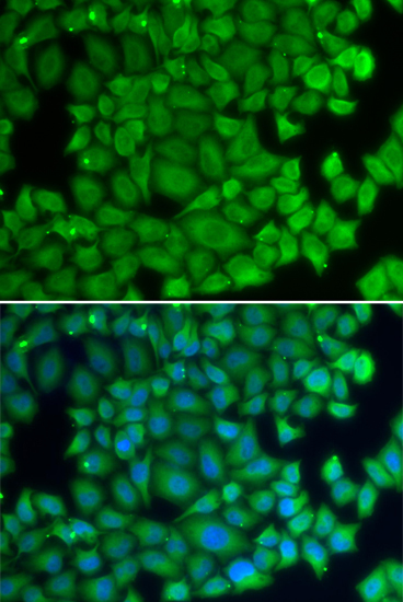 HSPB2 Rabbit Polyclonal Antibody - Image 2