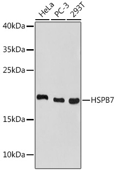 HSPB7 Rabbit Polyclonal Antibody