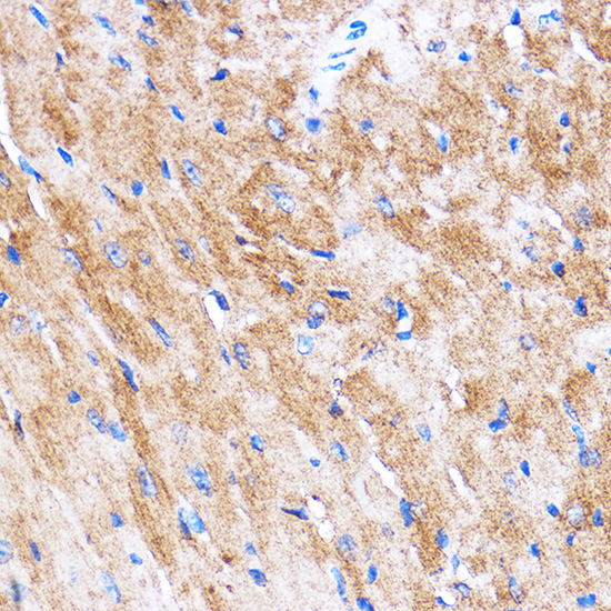 HSPB7 Rabbit Polyclonal Antibody - Image 2