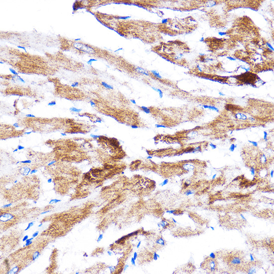 HSPB7 Rabbit Polyclonal Antibody - Image 3