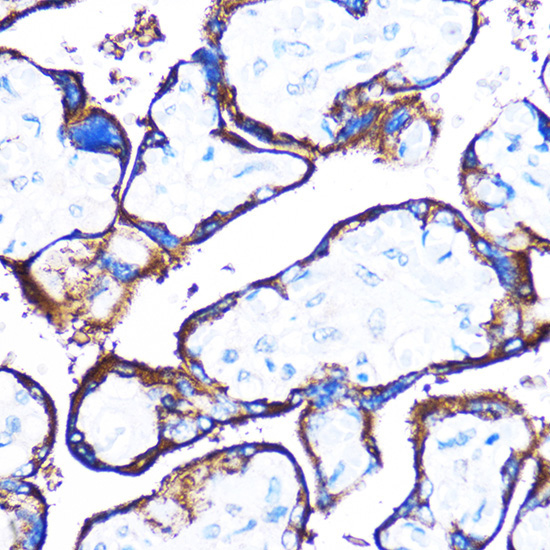 HSPB7 Rabbit Polyclonal Antibody - Image 4