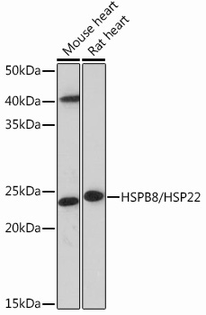 HSPB8/HSP22 Rabbit Monoclonal Antibody