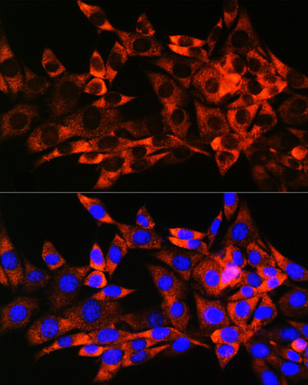 HSPB8/HSP22 Rabbit Monoclonal Antibody - Image 2