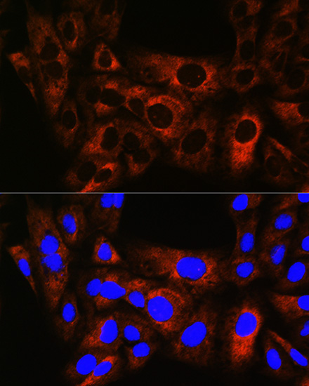HSPB8/HSP22 Rabbit Monoclonal Antibody - Image 3