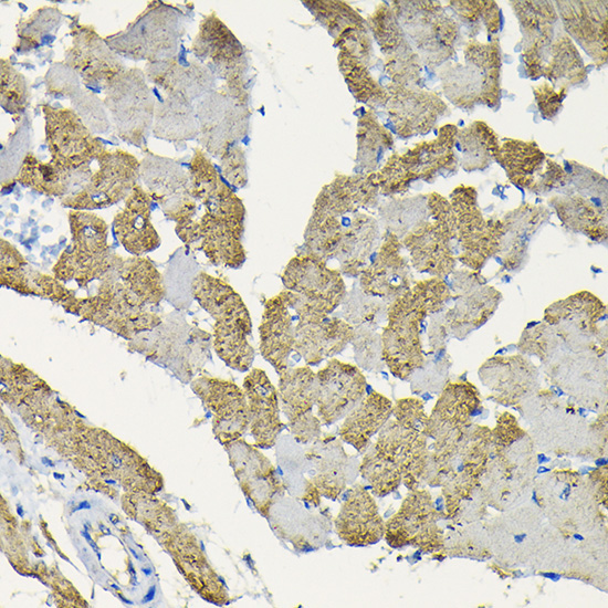 HSPB8/HSP22 Rabbit Polyclonal Antibody - Image 2