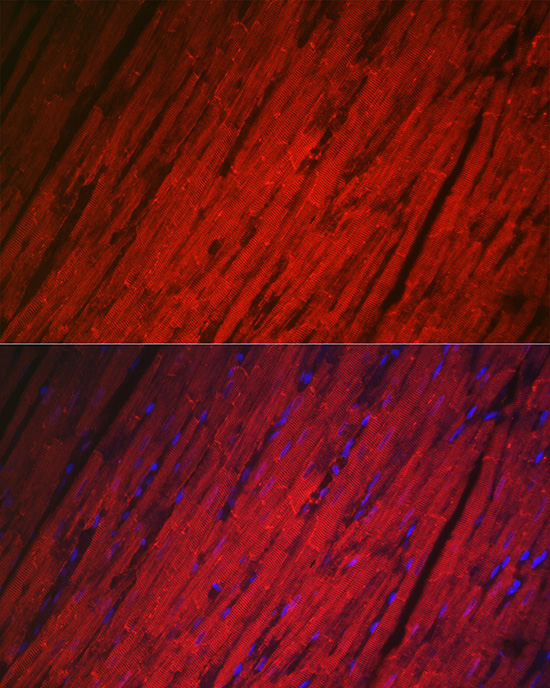 HSPB8/HSP22 Rabbit Polyclonal Antibody - Image 3