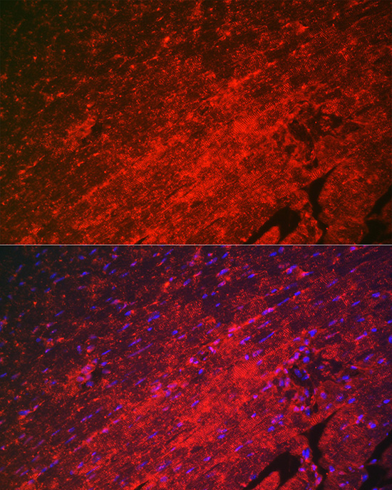 HSPB8/HSP22 Rabbit Polyclonal Antibody - Image 4