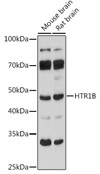 HTR1B Rabbit Polyclonal Antibody