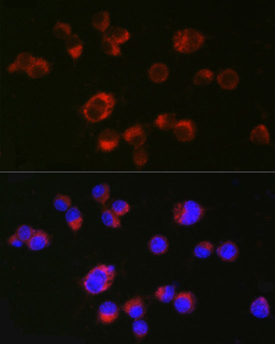 HTR2A Rabbit Polyclonal Antibody - Image 2