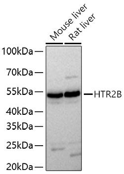 HTR2B Rabbit Polyclonal Antibody
