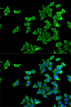 HTR2B Rabbit Polyclonal Antibody - Image 2