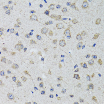 HTR3A Rabbit Polyclonal Antibody - Image 2