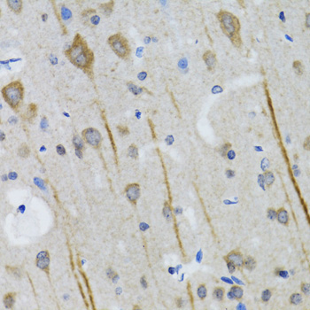 HTR3A Rabbit Polyclonal Antibody - Image 3