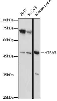 HTRA3 Rabbit Polyclonal Antibody